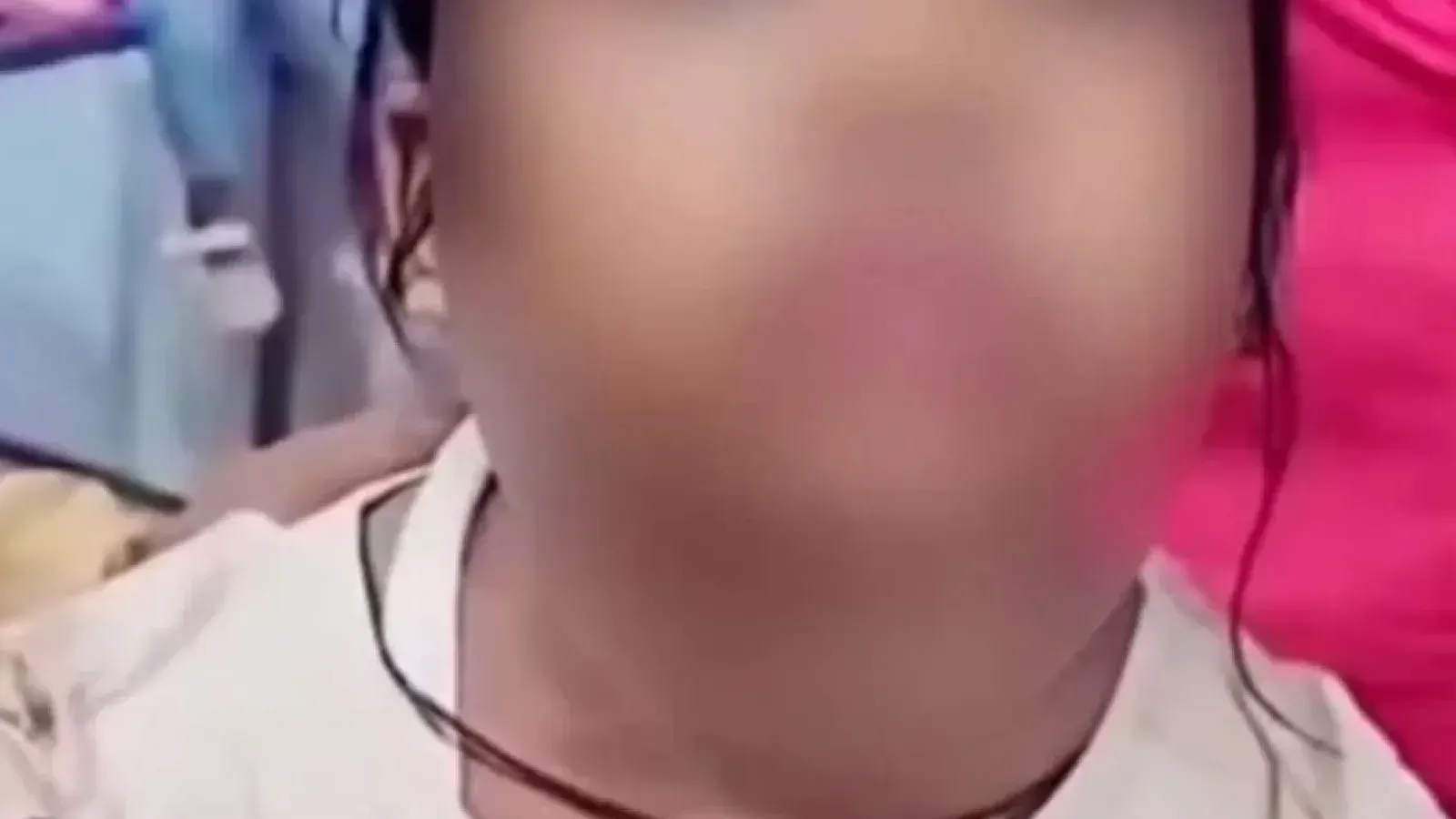 কুষ্টিয়ায় বিড়ালের আঁচড়ের পর শিশুর অস্বাভাবিক আচরণের ভিডিও ভাইরাল