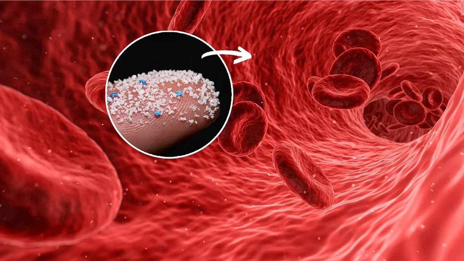 Microplastics Found in Human Bodies Posing Severe Health Risks