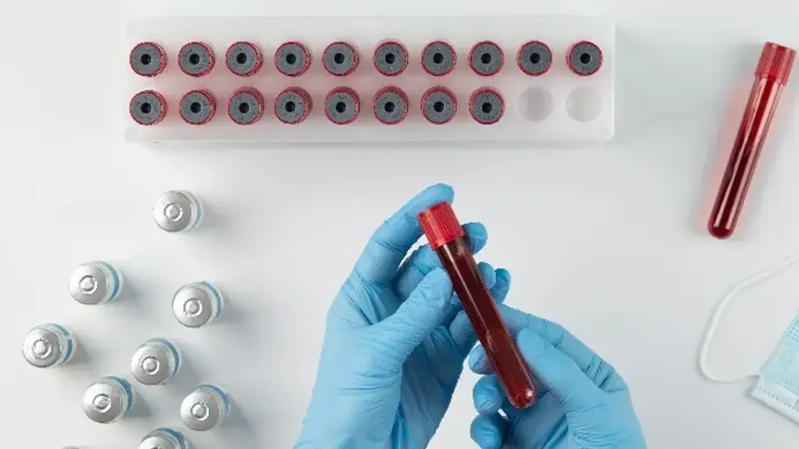 Islamic Ruling on Wudu and Blood Extraction in Bangladesh