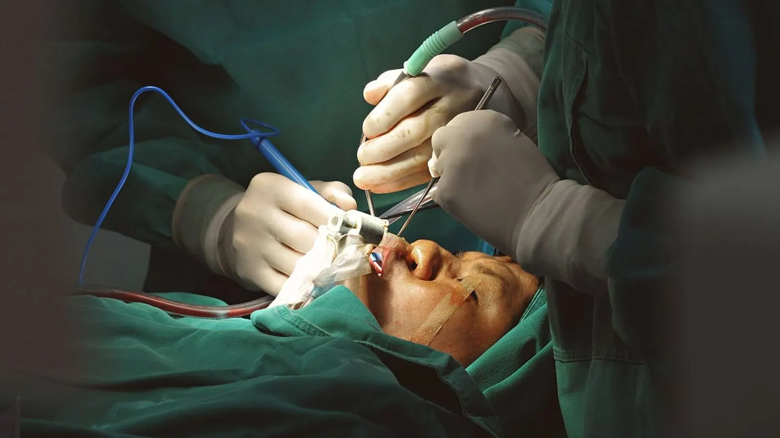 Islamic View on Cosmetic Procedures and Plastic Surgery