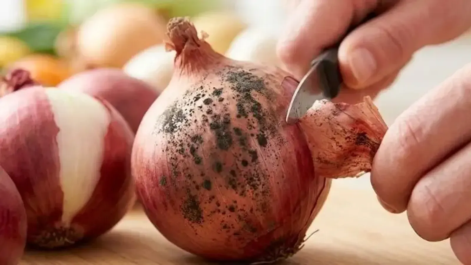 Bangladesh issues warning over black spots and fungal infections in onions